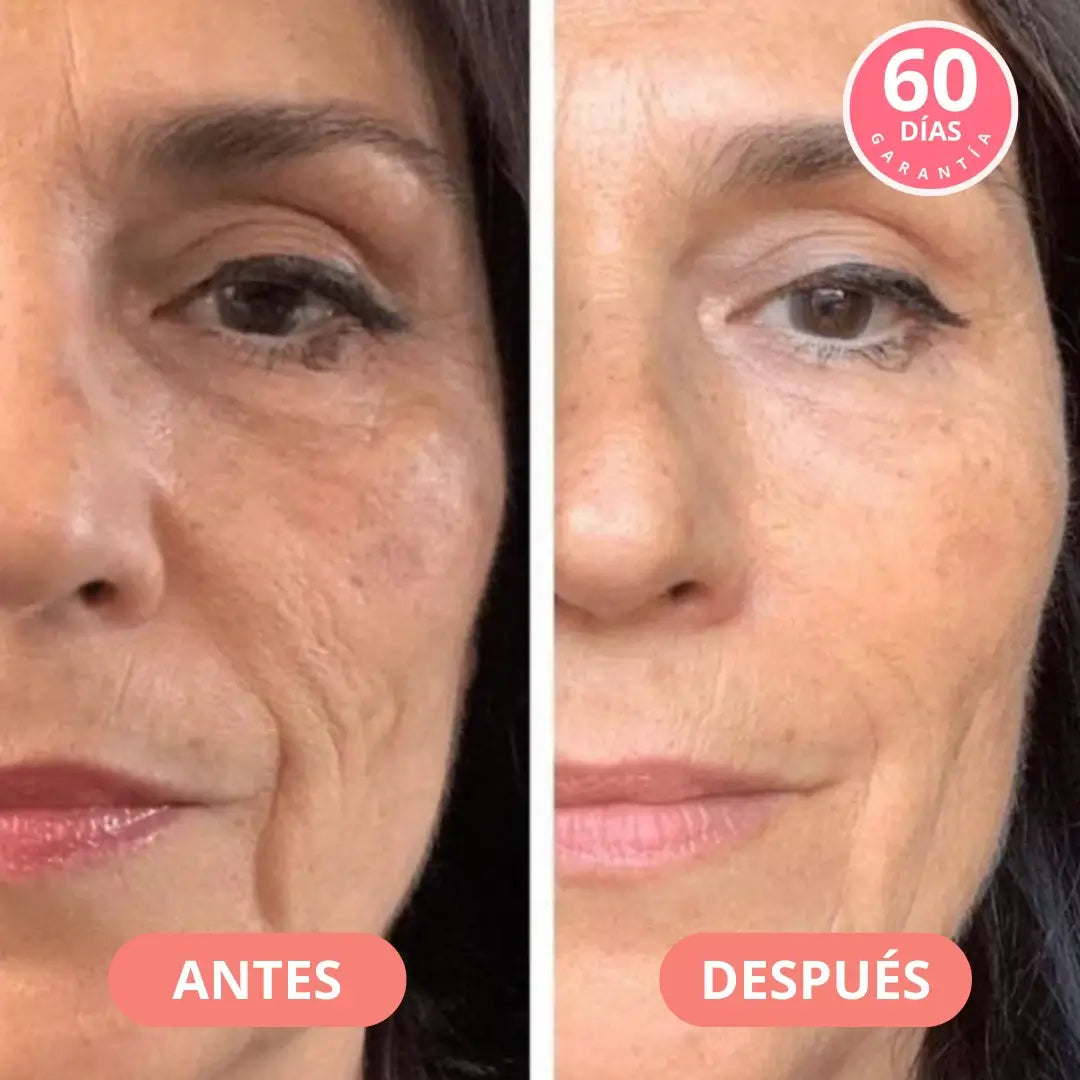 Face Glow 2.0™- Revitaliza tu piel