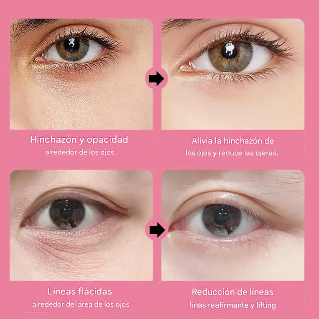 SADOER®|Adiós a las Ojeras y la Hinchazón