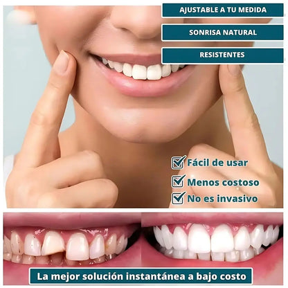 Smile Pro®| Sonrisa perfecta al instante, ¡Adiós inseguridad!